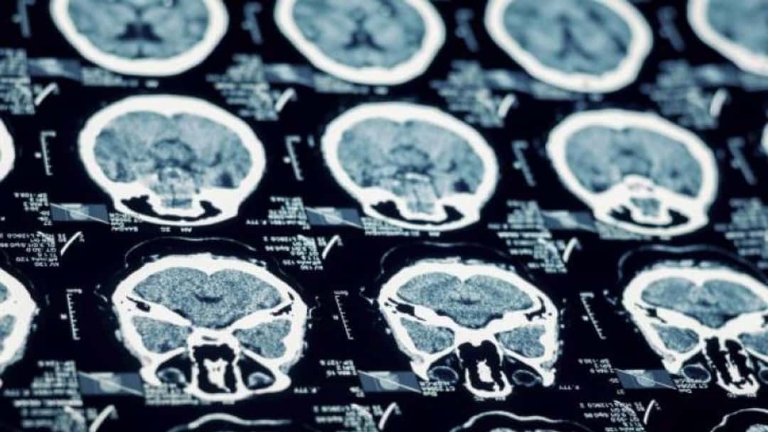 Court ruling reinforces anonymity for claimants