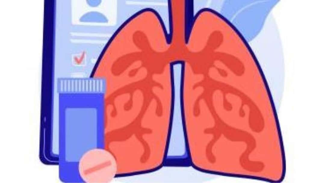 Mesothelioma: Secondary asbestos exposure 