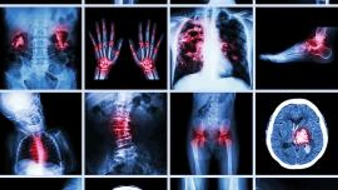 Critical time ahead for PI firms