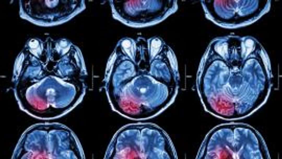 Brain injuries teach us what it is to be human