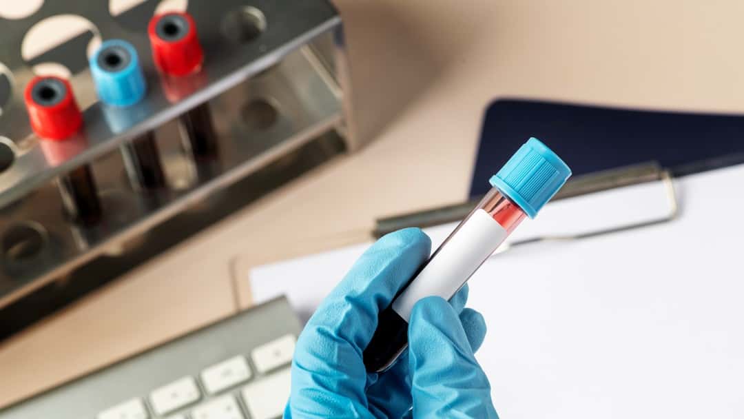 Infected blood compensation payments exempted from tax